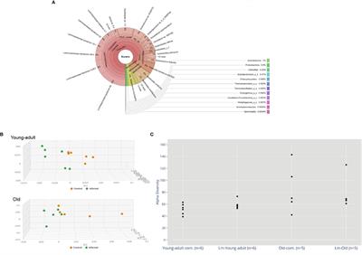 Aging-Induced Dysbiosis of Gut Microbiota as a Risk Factor for Increased Listeria monocytogenes Infection